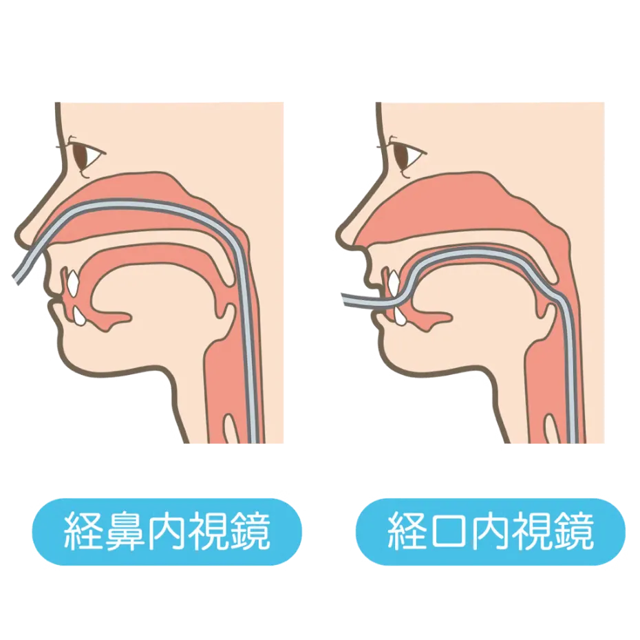 発熱外来